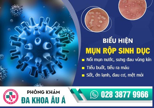 Triệu chứng bệnh mụn rộp sinh dục