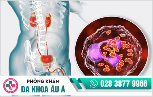 nguyên nhân bệnh lậu ở nam giới