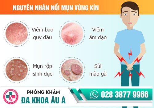 Dương vât nổi mụn là bị bệnh gì?