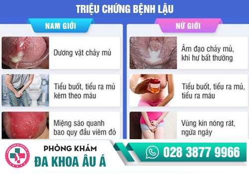Tiểu buốt có phải dấu hiệu của bệnh lậu không?