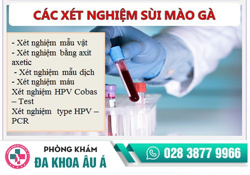 Cách xét nghiệm sùi mào gà hiện nay