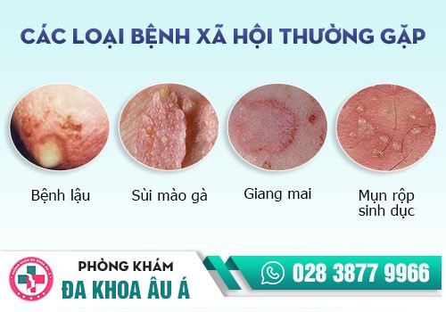 Khi nào cần chữa bệnh xã hội?