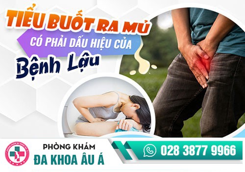 Tiểu buốt có phải dấu hiệu của bệnh lậu không?