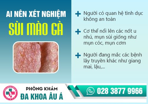 Quy trình xét nghiệm sùi mào gà