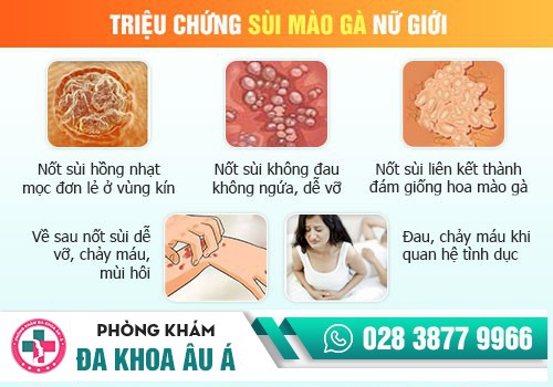 Cách nhận biết sùi mào gà ở âm đạo
